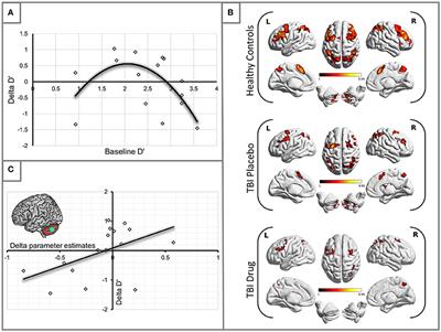 Working Memory after Traumatic Brain Injury: The Neural Basis of Improved Performance with Methylphenidate